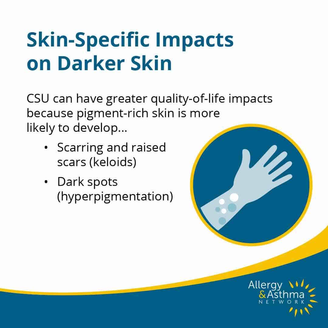 Hives on Black Skin and Other Skin of Color 48 Informational graphic about skin-specific impacts of CSU on darker skin, noting increased risk of scarring, keloids, and dark spots. Includes an illustration of a hand with scars and Allergy & Asthma Network logo.