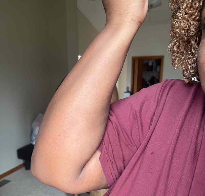 A person wearing a maroon shirt, with curly hair visible, raises their left arm, showing a smooth inner forearm. The background includes a beige wall, doorway, and some household items.