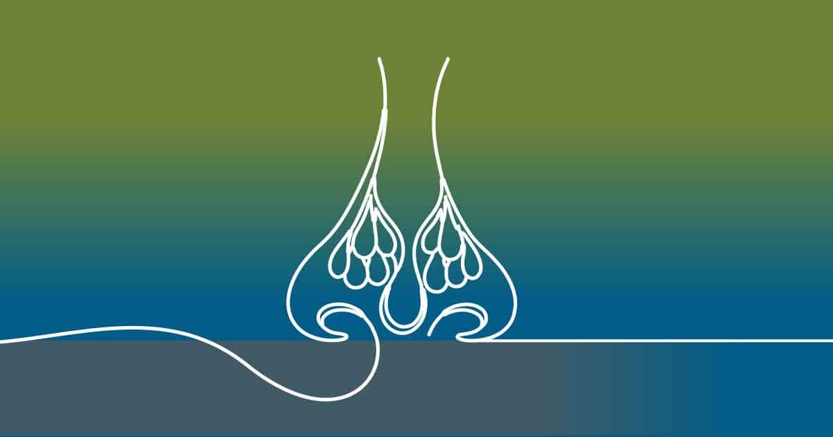 How to Treat Chronic Rhinosinusitis with Nasal Polyps (CRSwNP)