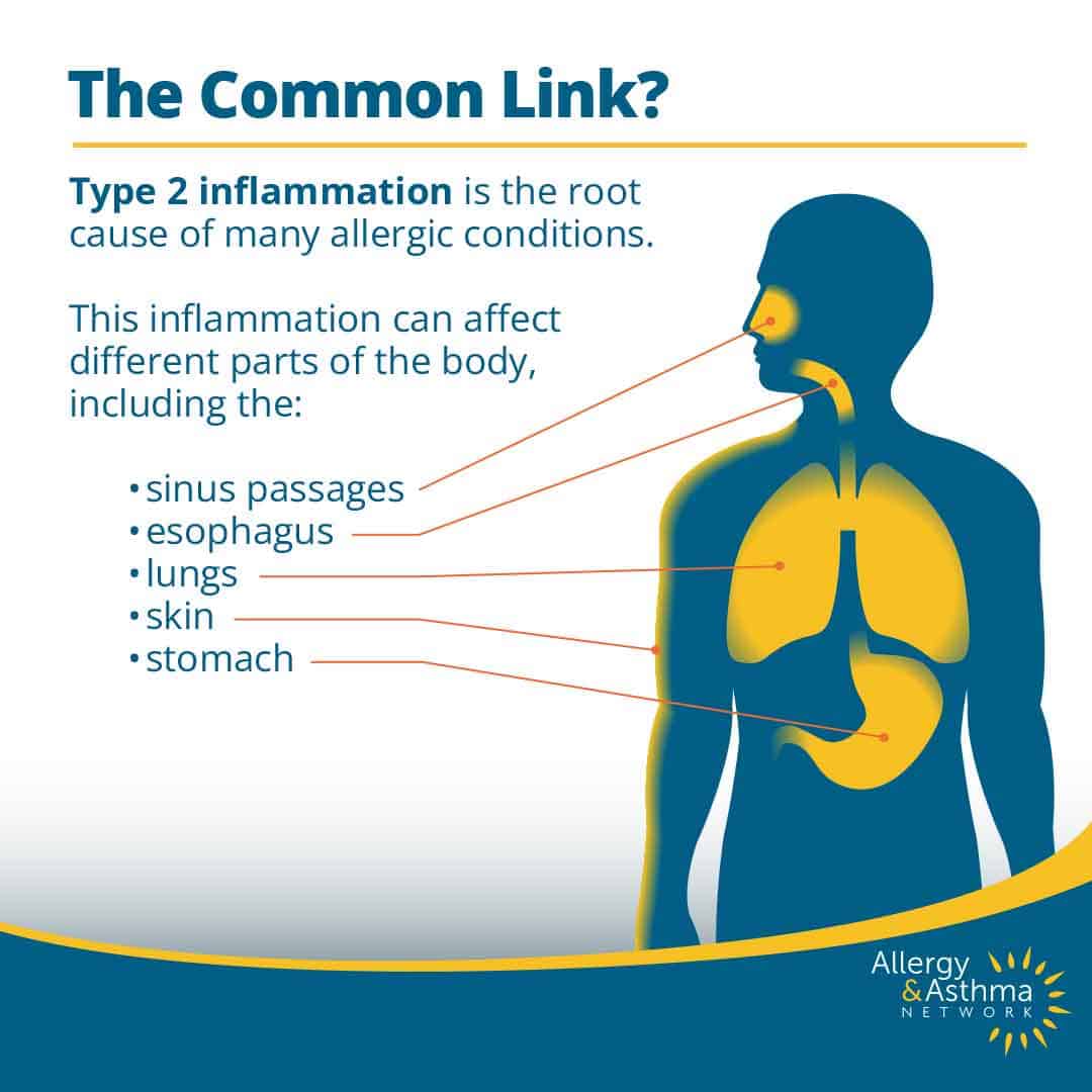 Diagram of a person’s silhouette highlighting the sinus passages, esophagus, lungs, skin, and stomach, showing how type 2 inflammation can affect multiple body parts in allergic conditions.