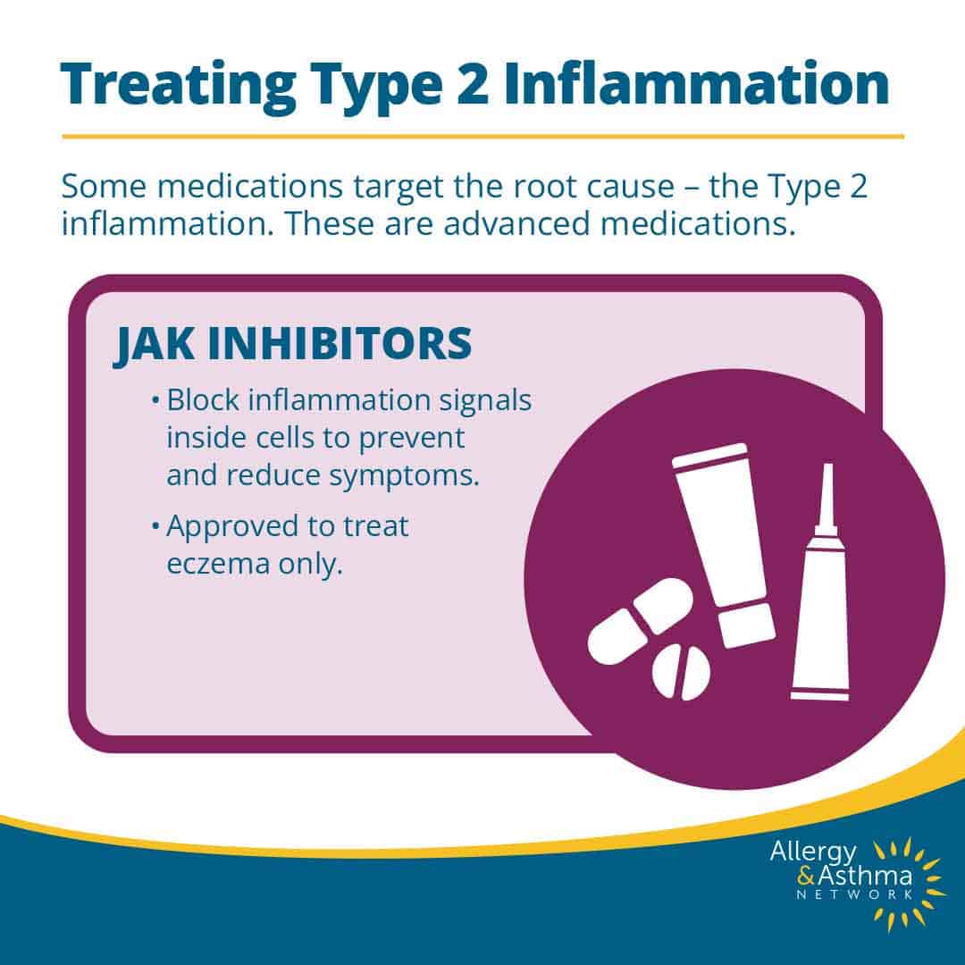 Infographic about treating Type 2 inflammation with JAK inhibitors, listing benefits such as blocking inflammation signals and note that they're approved for eczema only. Illustrated with medicine icons and Allergy & Asthma Network branding.