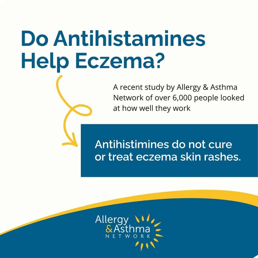 An Allergy & Asthma Network graphic titled “Do Antihistamines Help Eczema?” which states that antihistamines do not cure or treat eczema skin rashes.