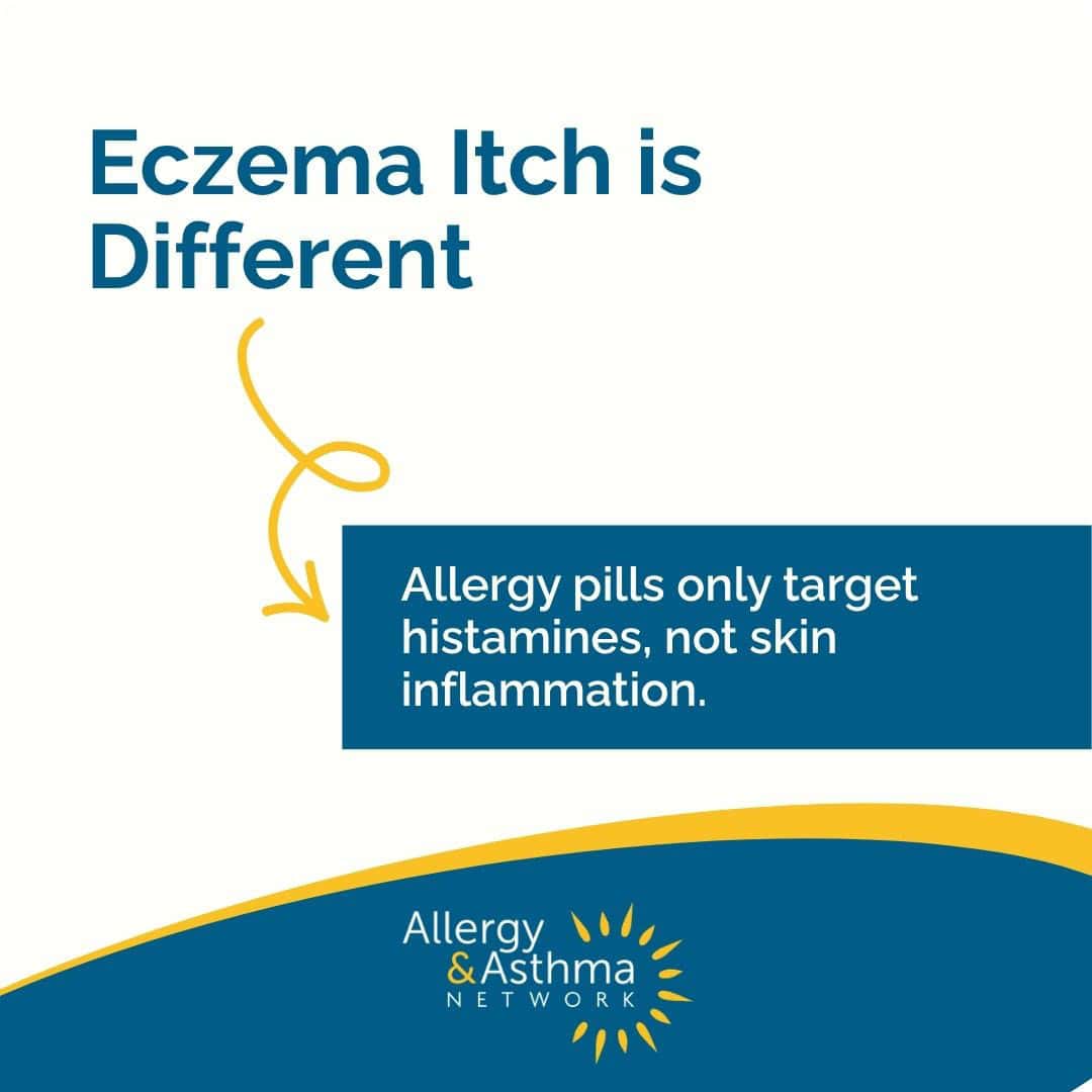 Educational graphic from the Allergy & Asthma Network stating, “Eczema Itch is Different,” and explaining that allergy pills target histamines rather than skin inflammation.